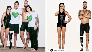 <i>Vogue</i> Brazil Photoshopped Models to Look Like They Have Disabilities